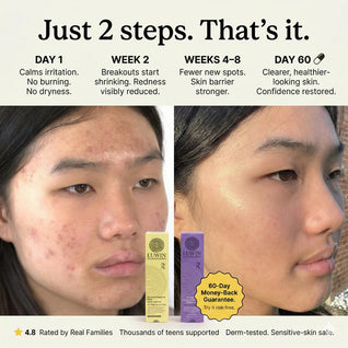 Advanced Calming & Clear Duo – Acne Cream & Calming Mist Set for Clear Skin | LUWIN