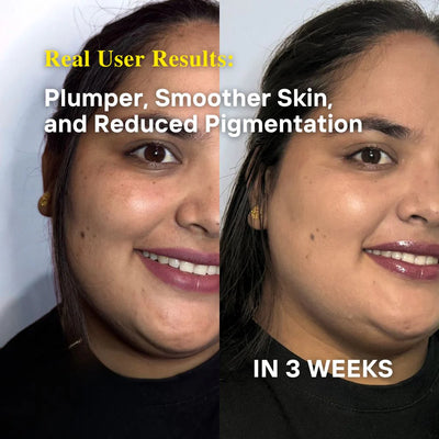 Ultimate Brightening & Rejuvenating Complete Set – Full Hyperpigmentation & Dark Spot Routine | LUWIN
