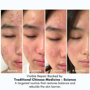 Advanced Clear & Brightening Super Set
