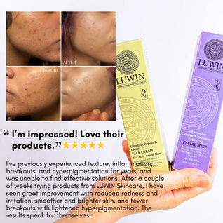 Ultimate Repair & Clear Face Cream for Acne-Prone Skin