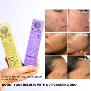 Ultimate Repair & Clear Face Cream for Acne-Prone Skin