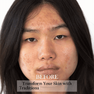 Advanced Clear &amp; Brightening Super Set image 8