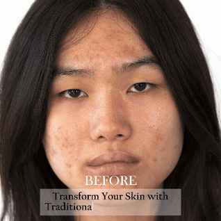 Advanced Clear & Brightening Super Set