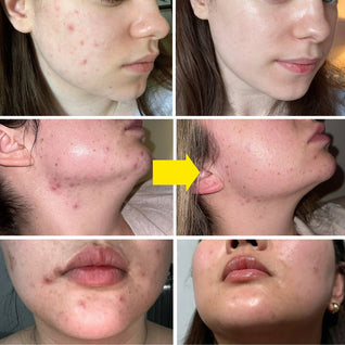 Advanced Clear & Brightening Super Set