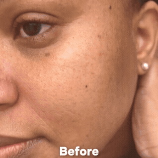 Ultimate Brightening & Rejuvenating Complete Set