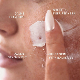 Ultimate Repair & Clear Face Cream for Acne-Prone Skin