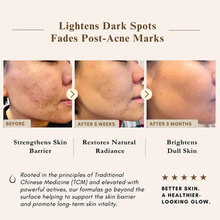 Powerful Brightening & Rejuvenating Duo – Hyperpigmentation Cream & Brightening Serum Set | LUWIN