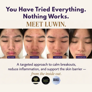 Advanced Calming & Clear Duo – Calming Mist & Face Cream Set for Clear Skin | LUWIN