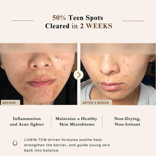 Before-and-after skin comparison graphic for a skincare product, showing a close-up of a person's lower face with acne on the left ('BEFORE') and clearer skin on the right ('AFTER 2 WEEKS'). Text at the top reads '50% Teen Spots Cleared in 2 WEEKS' and lists benefits such as reduced inflammation, healthy microbiome, and non-drying formula.