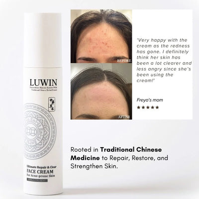 A white cylindrical tube of LUWIN Face Cream shown next to a before-and-after skin comparison photo and a customer testimonial by a user's mom on a light gray background.