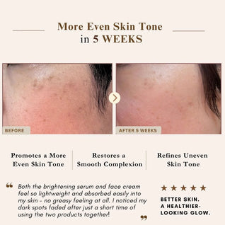 Powerful Brightening & Rejuvenating Duo – Hyperpigmentation Cream & Brightening Serum Set | LUWIN