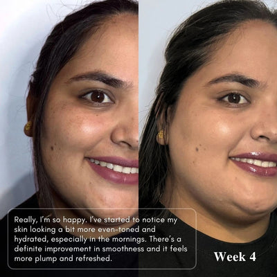 Before-and-after facial skin comparison of a woman, showing smoother and more even skin on the right side labeled 'Week 4' with a text overlay describing the benefits of LUWIN skincare.