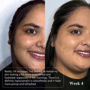 Powerful Brightening & Rejuvenating Duo – Hyperpigmentation Cream & Brightening Serum Set | LUWIN
