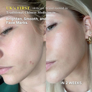 Powerful Brightening & Rejuvenating Duo – Hyperpigmentation Cream & Brightening Serum Set | LUWIN