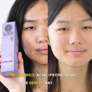 Advanced Calming & Clear Duo – Acne Cream & Calming Mist Set for Clear Skin | LUWIN
