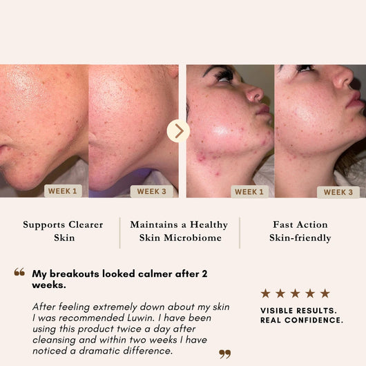 A skincare results graphic showing before-and-after close-up photos of a woman's jawline and cheek at Week 1 and Week 3, with text claiming support for clearer skin, healthy skin microbiome, and fast action skin-friendly benefits, plus a quote and five-star rating on LUWIN skincare. 