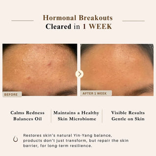 Advanced Clear & Brightening Super Set – Acne & Dark Spot Routine for Clear, Even Skin | LUWIN