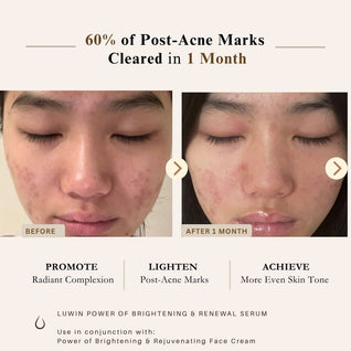 Ultimate Brightening & Rejuvenating Complete Set – Full Hyperpigmentation & Dark Spot Routine | LUWIN