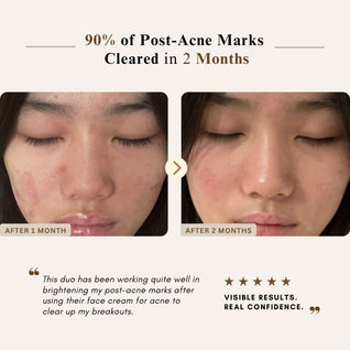 Ultimate Brightening & Rejuvenating Complete Set – Full Hyperpigmentation & Dark Spot Routine | LUWIN
