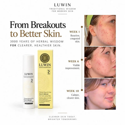 Luwin Traditional Wisdom for Modern Skin face cream advertisement showing a white and yellow tube and box alongside three before-and-after skin photos labeled Week 1, Week 6, and Week 10.