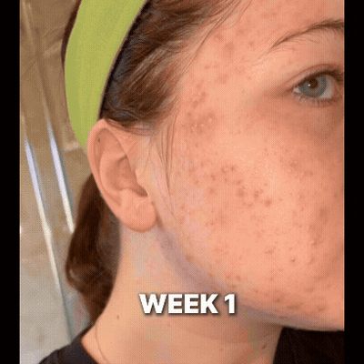 Advanced Clear &amp; Brightening Super Set image 4