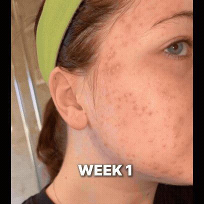 Advanced Clear &amp; Brightening Super Set image 4