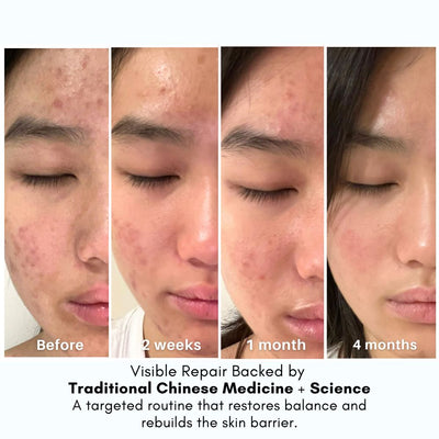 Advanced Clear &amp; Brightening Super Set image 1