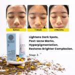 Before and after images of a teenage girl’s face showing significant improvement in acne after using LUWIN Powerful Brightening & Renewal face serum, accompanied by product packaging and dried herbal ingredients.images from before to 1 week then 2 month with massive clearer skin and improvement incomplexion. text says lightens dark spot, post-acen marks, hyperpigmentation, and restores brighter complexion.