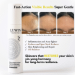 Before and after images showing visible acne improvement over 7 days using LUWIN Face Cream for acne-prone skin, featuring reduced inflammation, redness, and oiliness.