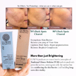 Before and after images demonstrating significant reduction in dark spots over 5 weeks and 3 months using LUWIN’s Brightening Duo (face serum and face cream). Images show improved skin tone, reduced hyperpigmentation, and restored brightness.