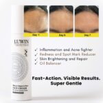 progressive skin improvement of a user's forehead from day 1 to day 5 and day7. text says anti-inflammatory, balances oil, skin brightening and repair, redness nad spot mark reducer. Fast action, visible results, super gentle.