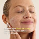 Model using LUWIN Ultimate Repair & Clear face cream on face with a smile, text says balance your skin's yin and yang, stop inflammation before it turns chronic.