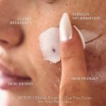 Close-up of a person applying LUWIN Ultimate Repair & Clear Face Cream for acne prone skin to their skin. The image highlights benefits like clearing breakouts, reducing inflammation, being non-drying, and skin-friendly.