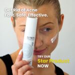 Model holds up a bottle of LUWIN Ultimate Repair & Clear Face Cream for Acne-Prone Skin to her face, text says get rid of acne fast, safe and effective. try our star product now