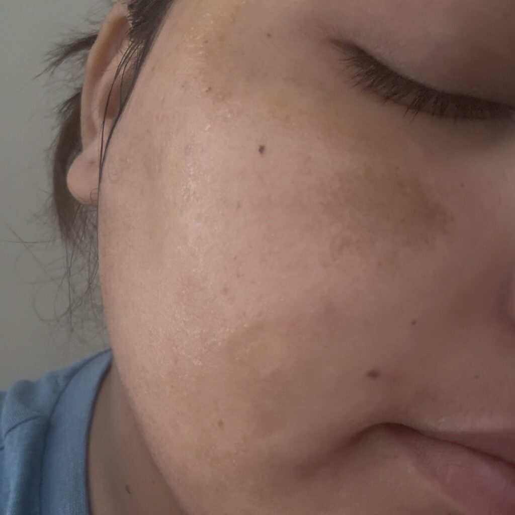 Image #1 from Kancha