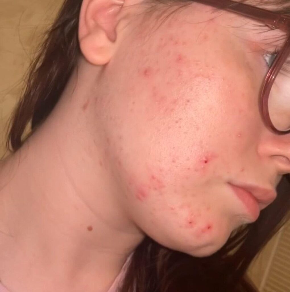 Image #2 from Sheree