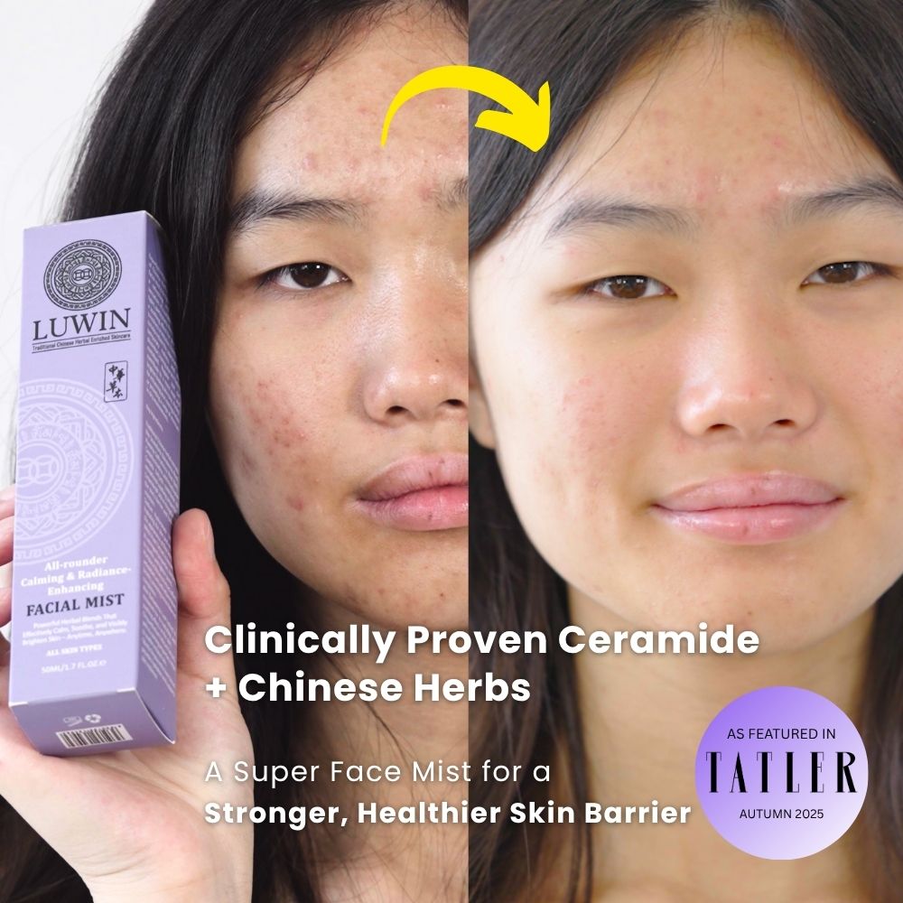 Side-by-side comparison of a young woman’s face before and after using LUWIN All-Rounder Calming & Radiance-Enhancing Facial Mist, showing reduced acne and redness. She holds the LUWIN product box, with Featured in Tatler Autumn 2025 badge and text overlay “Clinically Proven Ceramide + Chinese Herbs. for stronger, healthier skin in the winter.