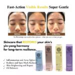 A skin journey from severe acne to 1 week later and then 2 months later images of a teenage's face showing progressive improvement of acne-prone skin using LUWIN skincare products, alongside product boxes and labelled stages of transformation.