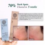 Side by side comparison of a lady's face with 70% reduction in hyperpigmentation and darks pot in 5 weeks, testimonial says LUWIN power of brightening & rejuventating duo set works very well in brightening up her skin and complexion.