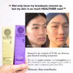 Close-up of a woman’s face showing severe acne before and smooth, healthy skin after using Luwin products. Includes boxes of Luwin Ultimate Repair & Clear Face Cream and All-rounder Calming & Radiance-Enhancing Facial Mist.