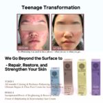 Before and after images of a teenage's face showing progressive improvement of acne-prone skin using LUWIN skincare products, alongside product boxes and labelled stages of transformation.