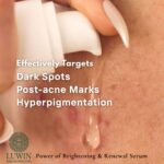 A drop of clear LUWIN Power of Brightening & Renewal Serum on a skin suface with redness and post-acne marks, with text overlay: Effectively Targets Dark Spots, Post-acne Marks, and Hyperpigmentation