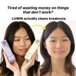 A side-by-side model transformation with 80% active breakouts cleared using LUWIN All-rounder Calming & Radiance-Enhancing Facial Mist and Ultimate Repair & Clear Face Cream, shows clearer skin after 1 month. text says: Tired of wasting money on things don't work? LUWIN actually clears breakouts.