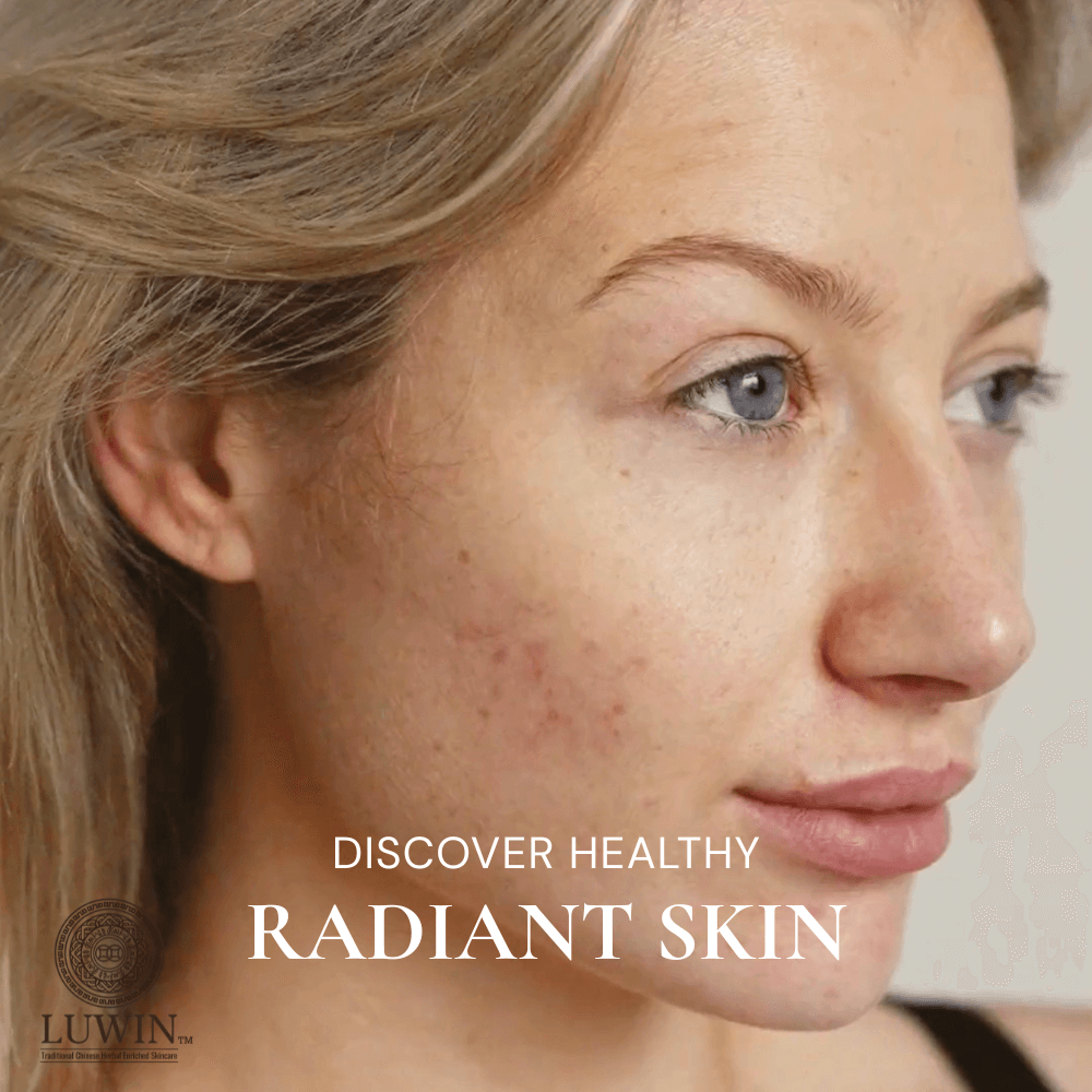 A close-up side profile of a woman with naturally textured skin showing mild redness and post-acne marks, showcasing real skin in a healthy state. Overlaid text reads: “Discover Healthy Radiant Skin.” LUWIN Traditional Chinese Herbal-Infused Skincare logo appears in the corner.